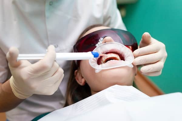 woman receiving teeth whitening treatment at a dentist office